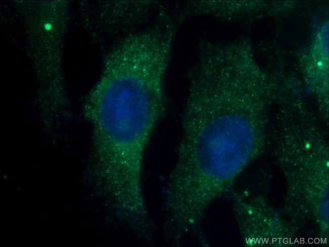 JNK2 Antibody in Immunocytochemistry (ICC/IF)