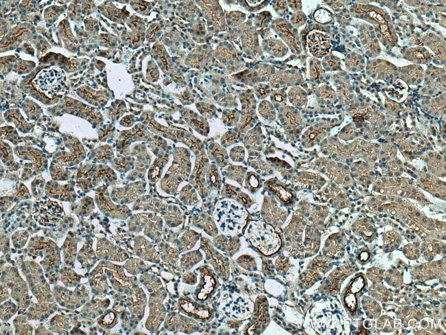 SLC5A10 Antibody in Immunohistochemistry (Paraffin) (IHC (P))