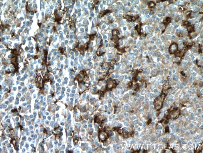 CD11c/Integrin alpha X Antibody in Immunohistochemistry (Paraffin) (IHC (P))