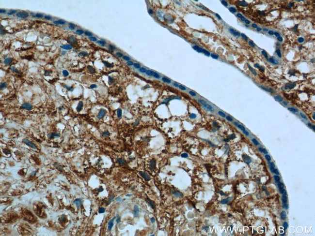 PLAC1L Antibody in Immunohistochemistry (Paraffin) (IHC (P))
