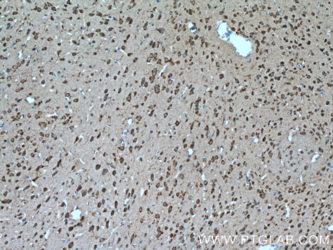 SLC25A18 Antibody in Immunohistochemistry (Paraffin) (IHC (P))