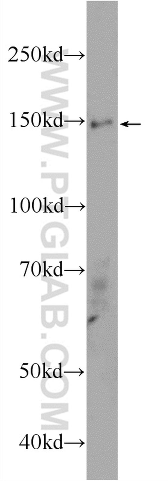 ASTN2 Antibody in Western Blot (WB)