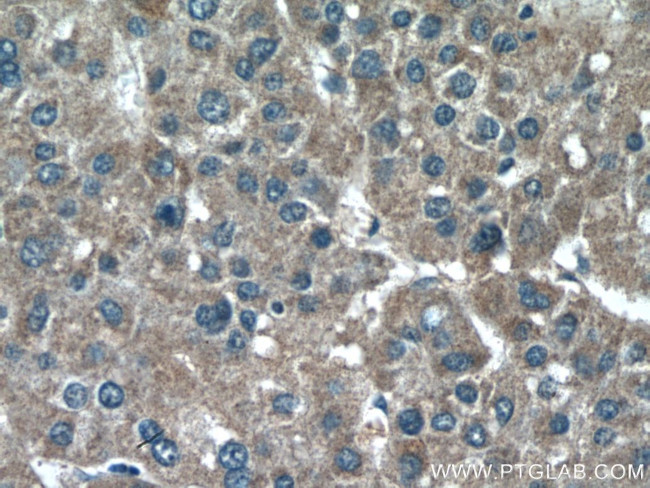 CHDH Antibody in Immunohistochemistry (Paraffin) (IHC (P))