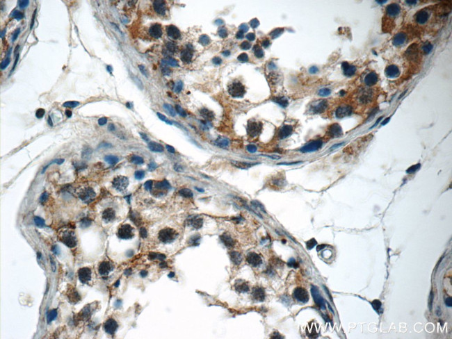 SPATA16 Antibody in Immunohistochemistry (Paraffin) (IHC (P))