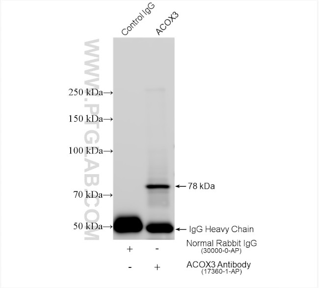 ACOX3 Antibody in Immunoprecipitation (IP)