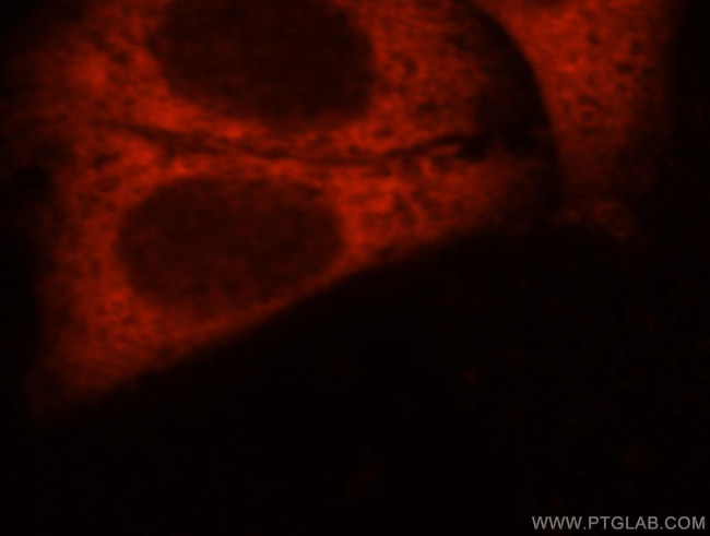 DNAJC5B Antibody in Immunocytochemistry (ICC/IF)