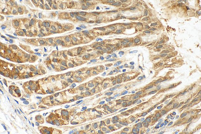 AP1S3 Antibody in Immunohistochemistry (Paraffin) (IHC (P))