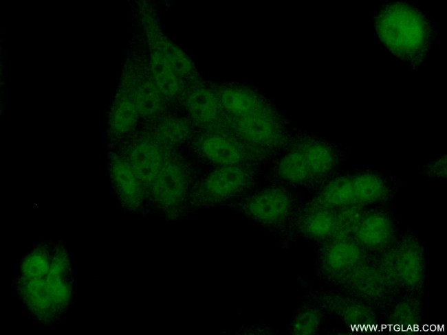 TEX10 Antibody in Immunocytochemistry (ICC/IF)