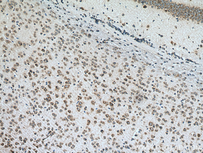 RPS29 Antibody in Immunohistochemistry (Paraffin) (IHC (P))