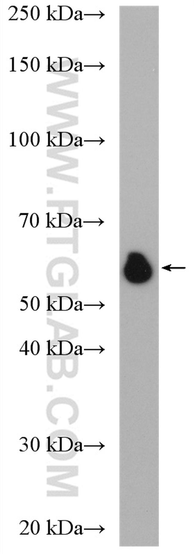 GPBP1L1 Antibody in Western Blot (WB)