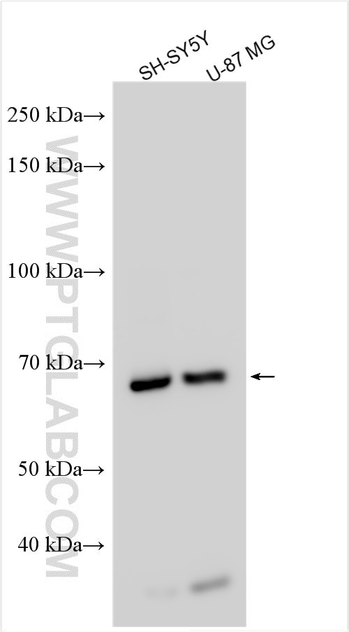TCP11L2 Antibody in Western Blot (WB)