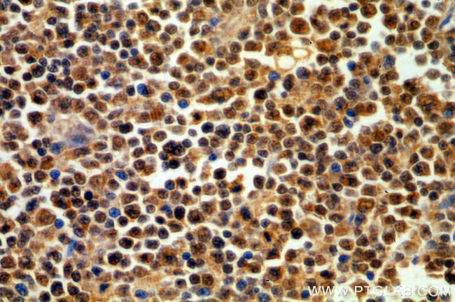 DNTT/TDT Antibody in Immunohistochemistry (Paraffin) (IHC (P))