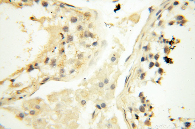 SAMD4A Antibody in Immunohistochemistry (Paraffin) (IHC (P))