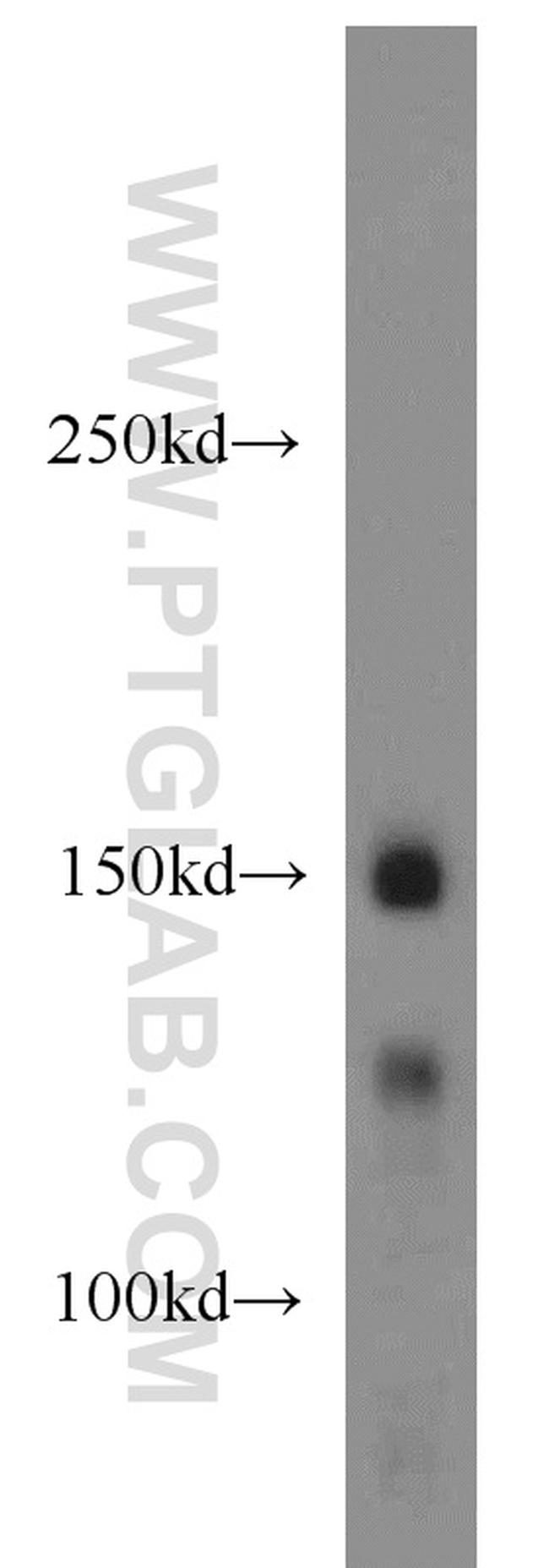 PRPF40A Antibody in Western Blot (WB)