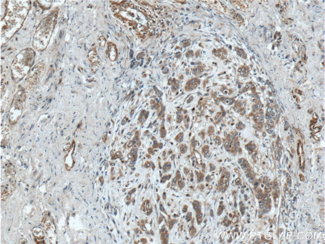 NUBPL Antibody in Immunohistochemistry (Paraffin) (IHC (P))