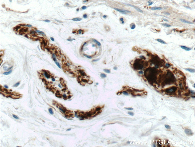 Peripherin Antibody in Immunohistochemistry (Paraffin) (IHC (P))