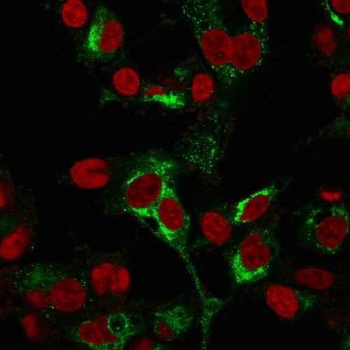 AFP (Alpha Fetoprotein) Antibody in Immunocytochemistry (ICC/IF)