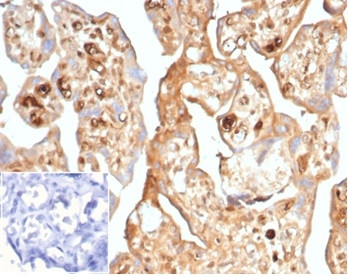 AFP (Alpha Fetoprotein) (Hepatocellular/Germ Cell Tumor Marker) Antibody in Immunohistochemistry (Paraffin) (IHC (P))