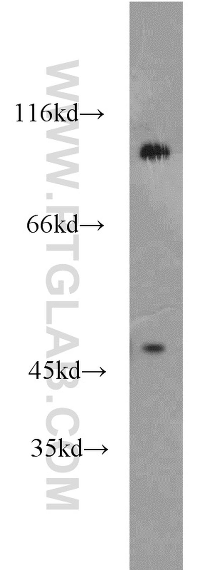 PSD2 Antibody in Western Blot (WB)