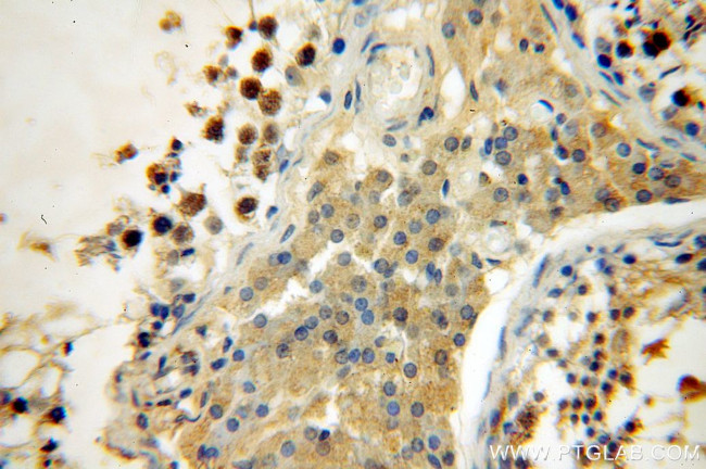 SYCE1 Antibody in Immunohistochemistry (Paraffin) (IHC (P))