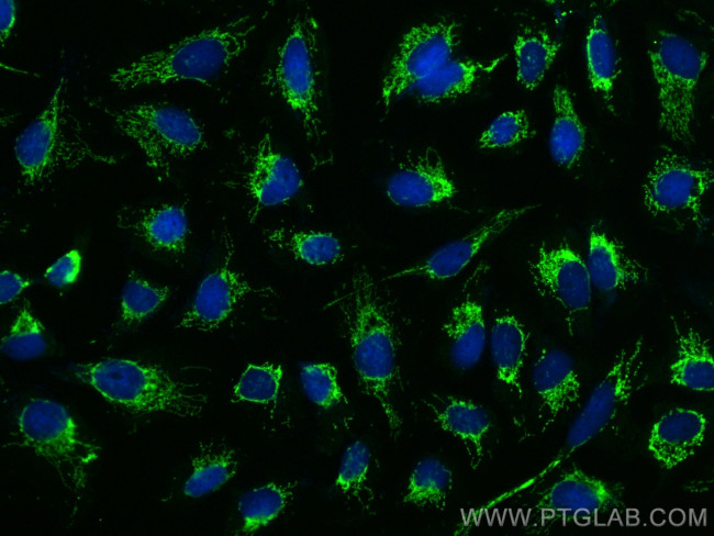 RIOK2 Antibody in Immunocytochemistry (ICC/IF)