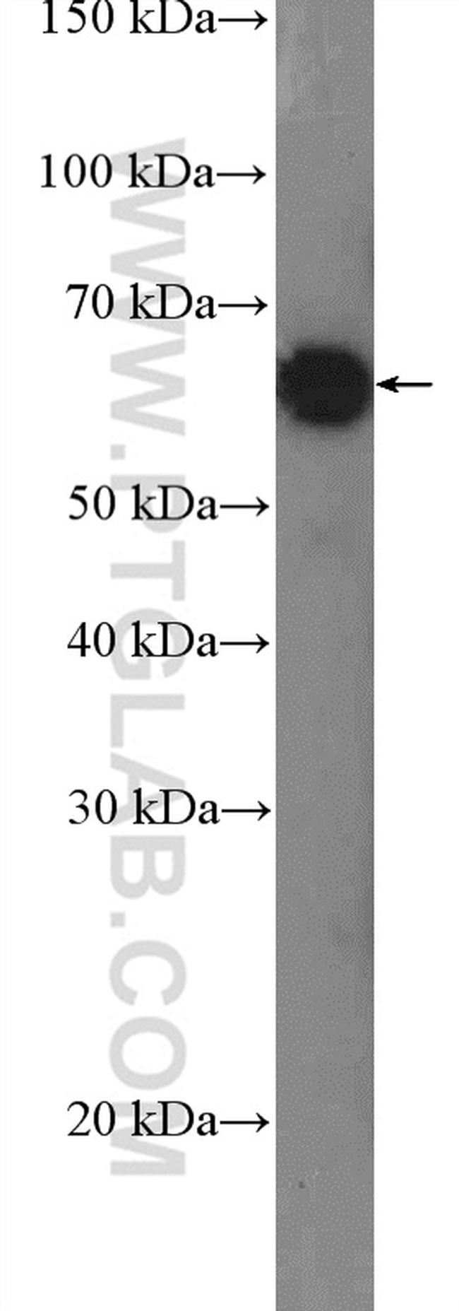 TESK2 Antibody in Western Blot (WB)