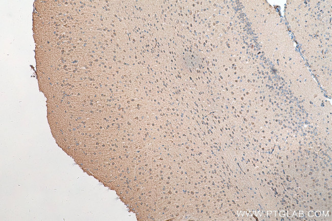FJX1 Antibody in Immunohistochemistry (Paraffin) (IHC (P))
