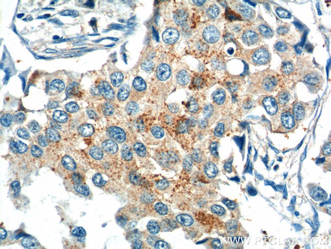 KIF26B Antibody in Immunohistochemistry (Paraffin) (IHC (P))