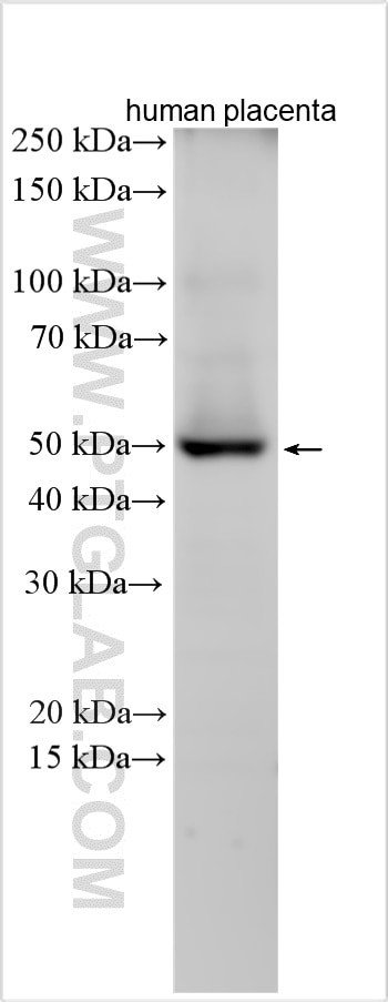 CDK15 Antibody in Western Blot (WB)