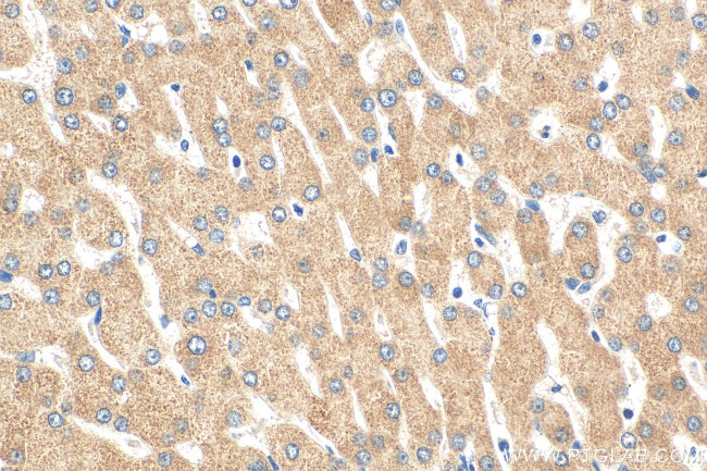SLC25A41 Antibody in Immunohistochemistry (Paraffin) (IHC (P))