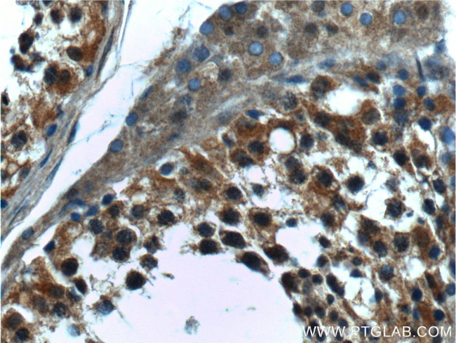 CTAGE6 Antibody in Immunohistochemistry (Paraffin) (IHC (P))