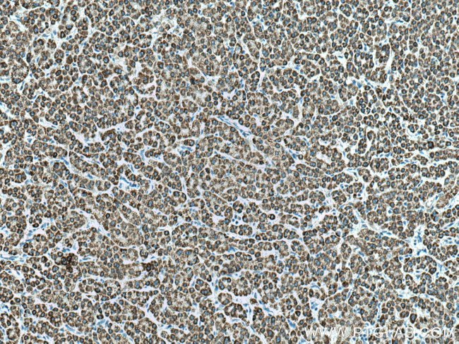 ACADL Antibody in Immunohistochemistry (Paraffin) (IHC (P))
