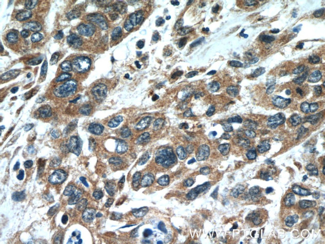 Oligophrenin 1 Antibody in Immunohistochemistry (Paraffin) (IHC (P))