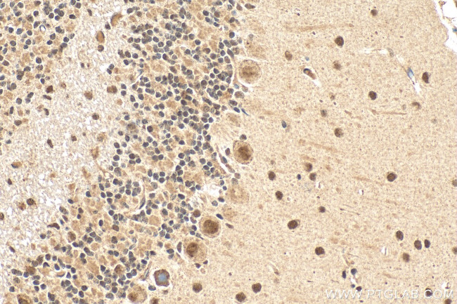 ZNF8 Antibody in Immunohistochemistry (Paraffin) (IHC (P))