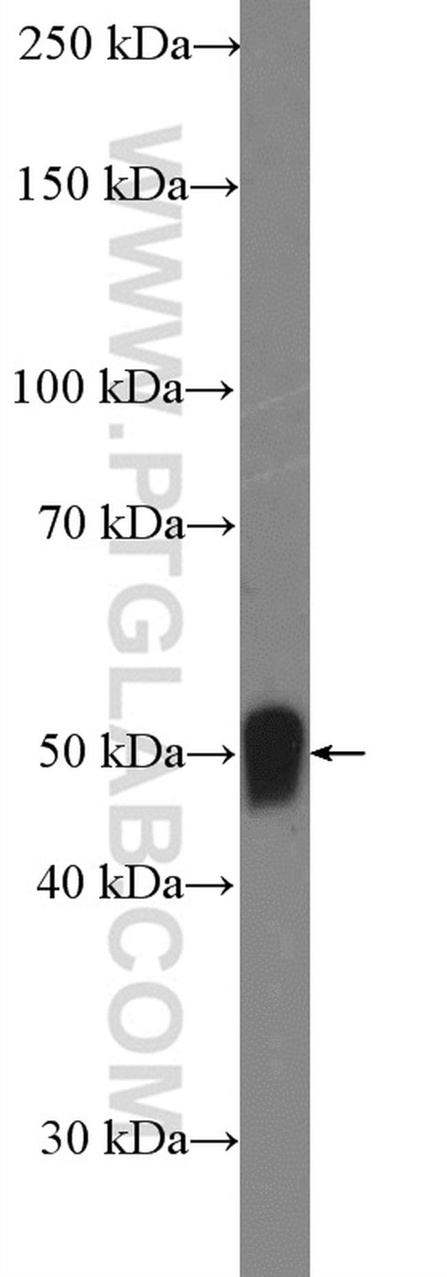 SERPINA12 Antibody in Western Blot (WB)