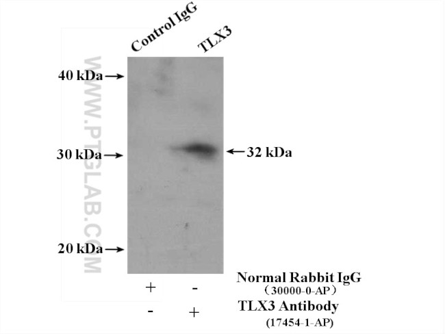 TLX3 Antibody in Immunoprecipitation (IP)