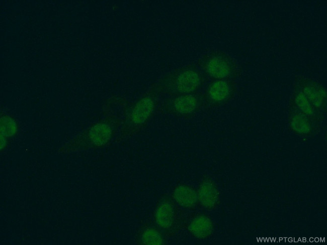 SKAR Antibody in Immunocytochemistry (ICC/IF)