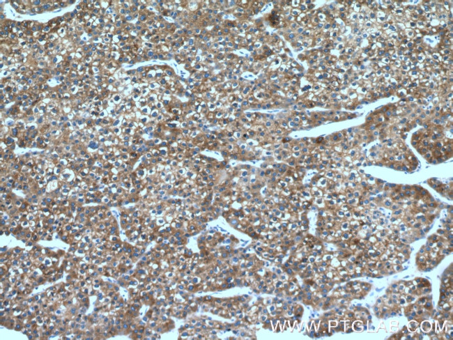 FMO3 Antibody in Immunohistochemistry (Paraffin) (IHC (P))