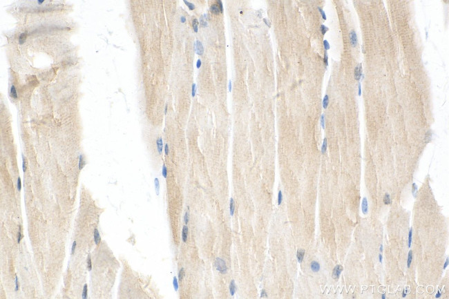 MRPL43 Antibody in Immunohistochemistry (Paraffin) (IHC (P))