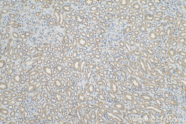 YTHDF1 Antibody in Immunohistochemistry (Paraffin) (IHC (P))