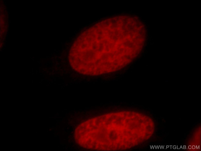 PDS5A Antibody in Immunocytochemistry (ICC/IF)