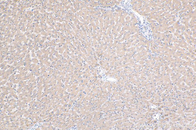 Synaptotagmin-6 Antibody in Immunohistochemistry (Paraffin) (IHC (P))