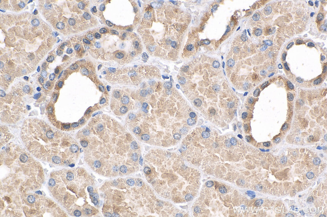 USP20 Antibody in Immunohistochemistry (Paraffin) (IHC (P))