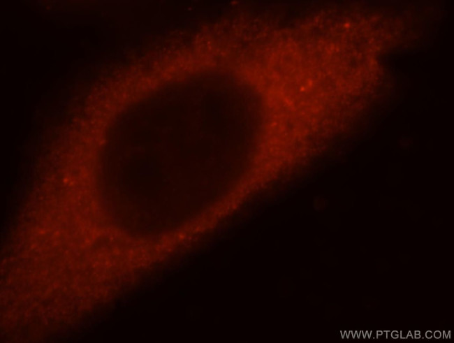 Filensin Antibody in Immunocytochemistry (ICC/IF)