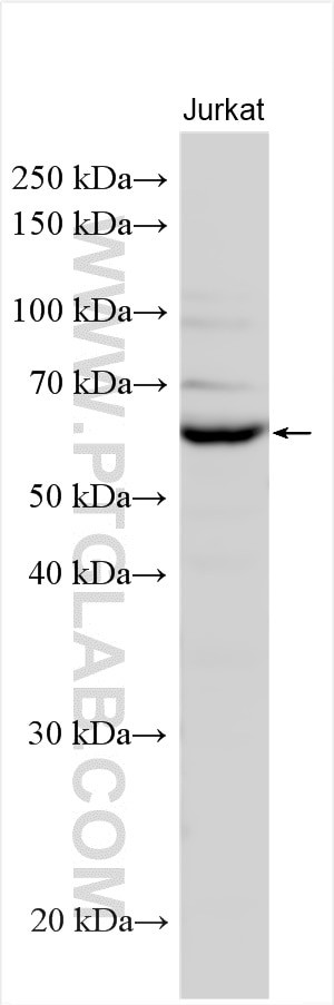 TCP11L1 Antibody in Western Blot (WB)