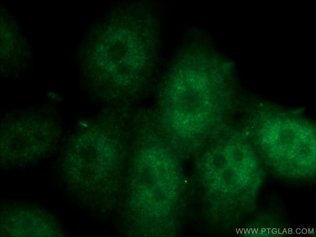 SPAG4L Antibody in Immunocytochemistry (ICC/IF)