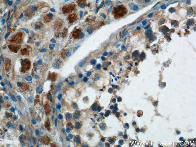 SPATA3 Antibody in Immunohistochemistry (Paraffin) (IHC (P))