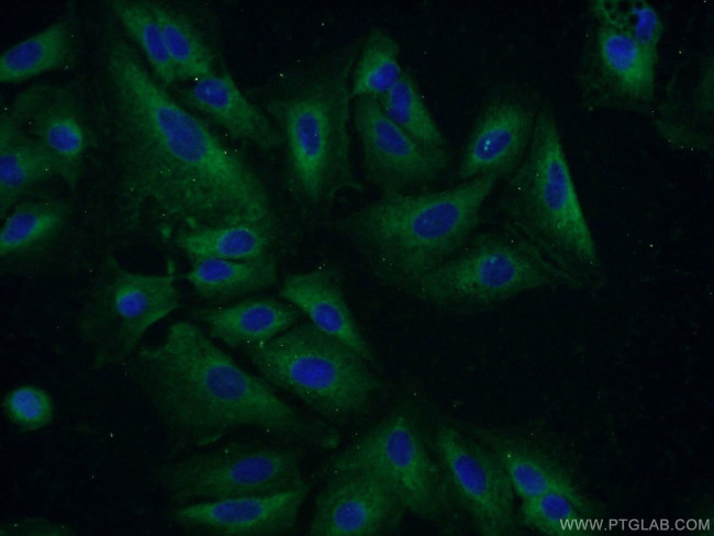 GSTCD Antibody in Immunocytochemistry (ICC/IF)