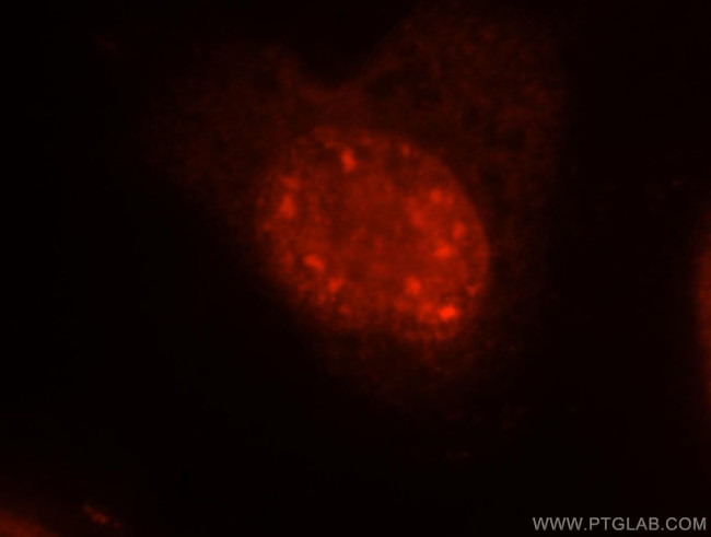 EIF4A3 Antibody in Immunocytochemistry (ICC/IF)