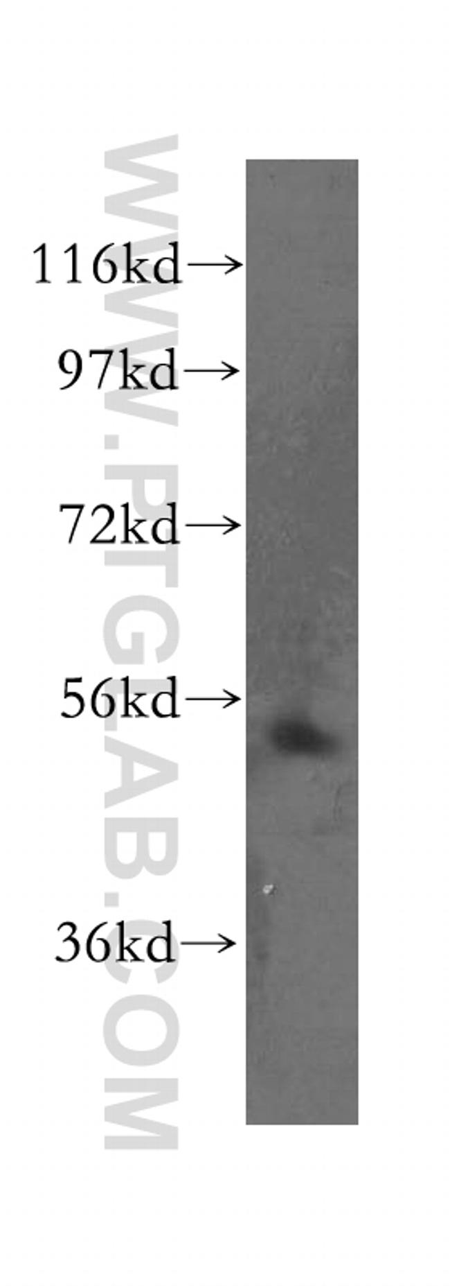 TOM1 Antibody in Western Blot (WB)